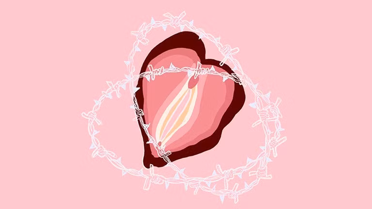 Hội chứng co thắt âm đạo (Vaginismus) là một dạng rối loạn chức năng tình dục xảy ra ở bộ phận âm đạo/Ảnh minh hoạ/Nguồn Internet