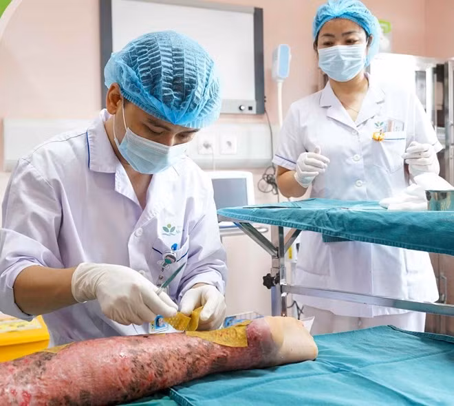 Bệnh nhi được các y bác sĩ chăm sóc vết bỏng nặng. Ảnh Bệnh viện Nhi Trung ương