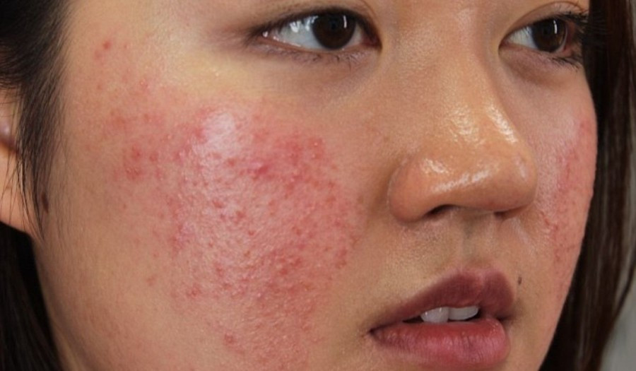 Mỹ phẩm kém chất lượng chứa nhiều hoạt chất nguy hiểm khiến làn da hư hỏng nặng. Ảnh minh họa/Nguồn vneconomy.vn