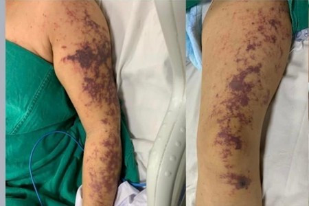 Ảnh minh họa/Nguồn moh.gov.vn