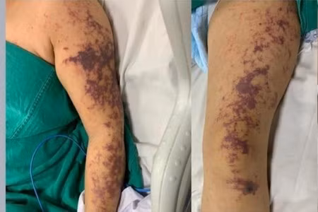 Ảnh minh họa/Nguồn moh.gov.vn