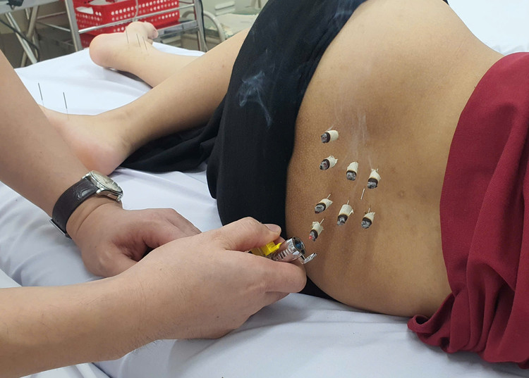 Đông Y trị bí tiểu sau sinh - Ảnh BVCC bi-tieu-sau-sinh-1.jpg