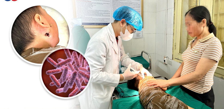 Trẻ 4 tuổi nhiễm khuẩn huyết do vi khuẩn ăn thịt người - Ảnh BVCC thit-nguoi.jpg
