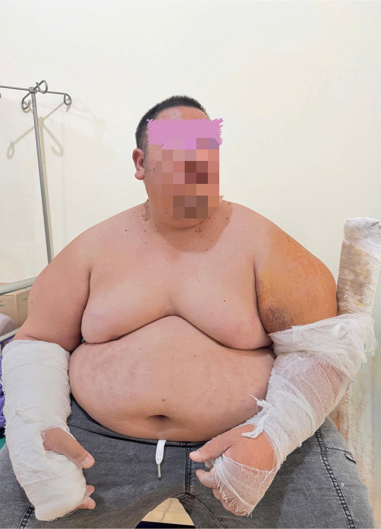 Bệnh nhân hồi phục sau phẫu thuật - Ảnh BVCC gay-te-3.jpg