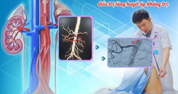 ThS.Bs Ngô Văn Tuấn thăm khám cho bệnh nhân sau can thiệp - Ảnh BVCC ha-khang-tri-7122.jpg