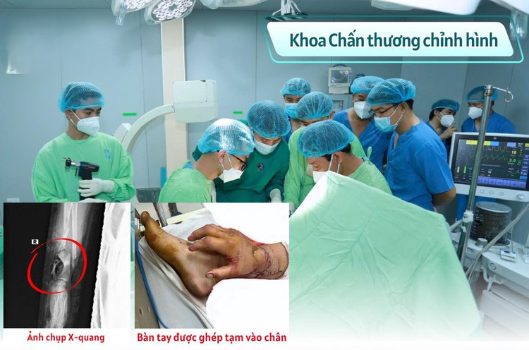 Ê - kíp phẫu thuật cho sản phụ - Ảnh BVCC ghep-tay-dut-lia.jpg