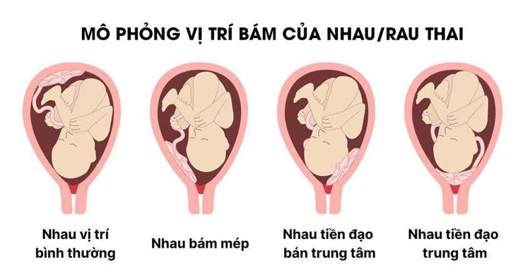 rau-tien-dao-2.jpg
