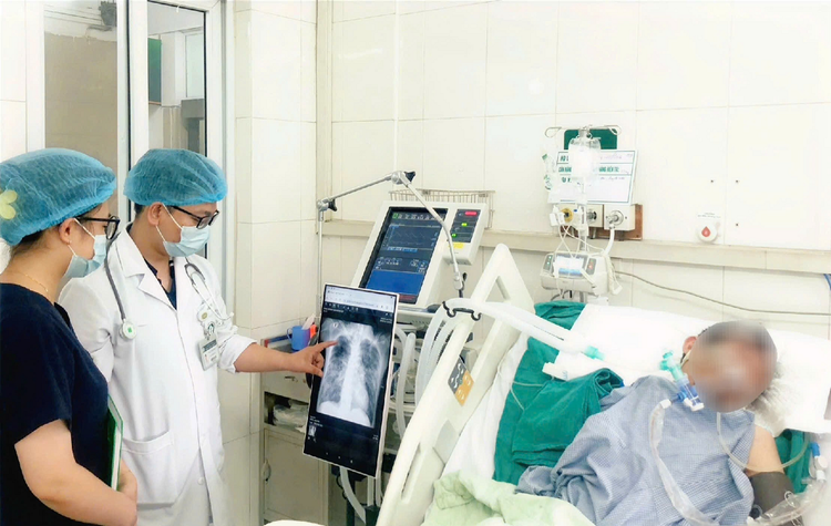 Bệnh nhân viêm phổi, suy hô hấp nặng đang điều trị tại Bệnh viện Bạch Mai - Ảnh BVCC soi-nguy-kich.png