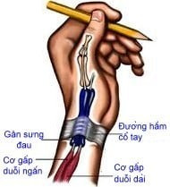 Biểu hiện của bệnh - Ảnh BSCC anh-2.jpg