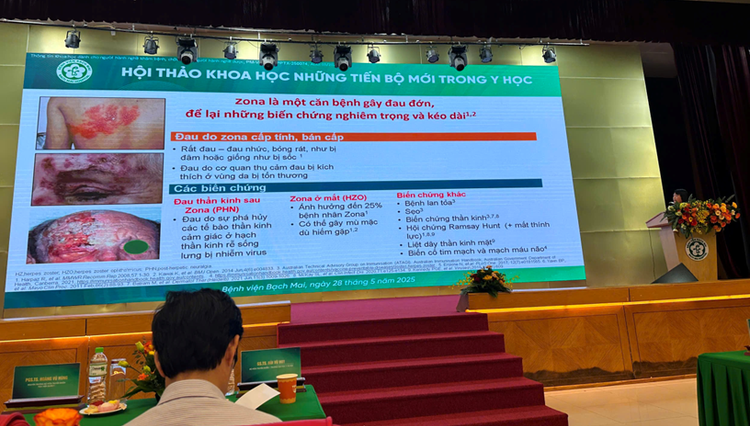 Vắc xin tấm khiên phòng bệnh Zona hiệu quả cho người cao tuổi, người có bệnh nền - Ảnh BVCC vacxin-zona.png
