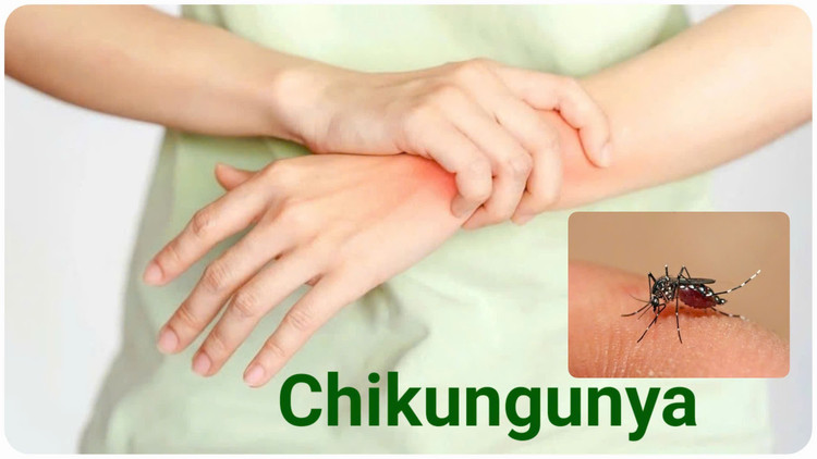 Ảnh BVCC chiku.jpg