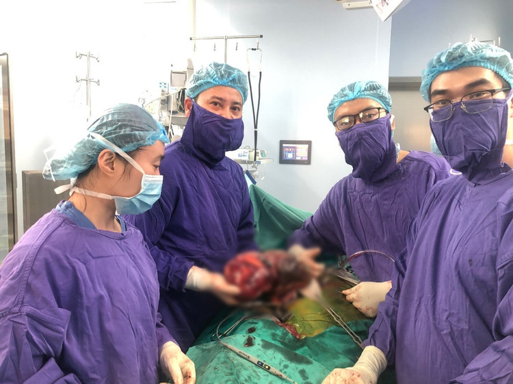 Cắt khối u nang thận khổng lồ 2,8 kg - BVCC cat-bo-than-da-nang.jpg
