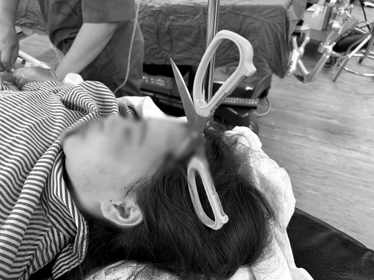 Hình ảnh kéo sắc nhọn đâm xuyên não - Ảnh BVCC bnkeodam-1.jpg