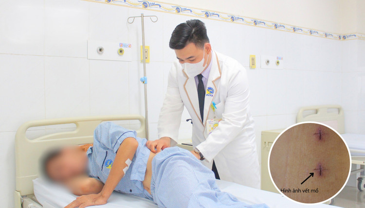 Thăm khám cho bệnh nhân sau phẫu thuật - Ảnh BVCC thoat-vi-tx.jpg