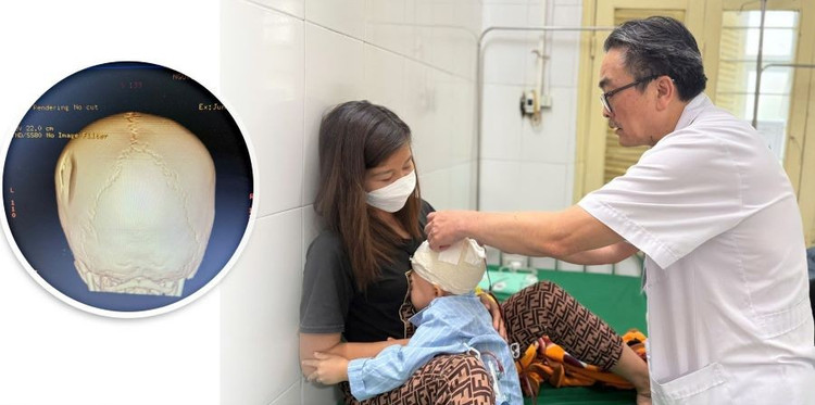 Thăm khám cho bệnh nhân chấn thương sọ não nặng sau phẫu thuật - Ảnh BVCC chan-thuong.jpg