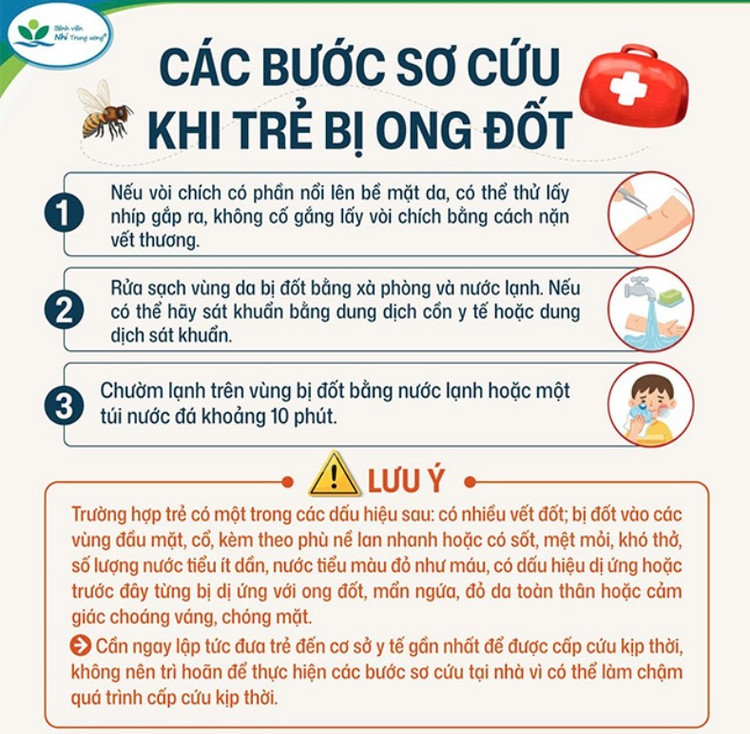 Ảnh minh họa BVCC soc-ong-4.jpg