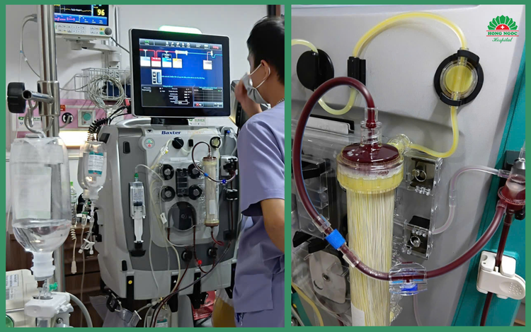 Hệ thống lọc máu trong 49 giờ liên tục giúp bệnh nhân thoát khỏi tình trạng nguy kịch - Ảnh BVCC 49h1.png