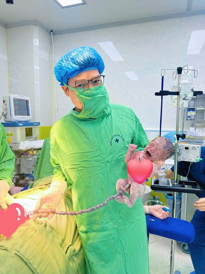 Bé gái có dây rốn dài thắt nút - Ảnh BVCC day-ron-nhieu-vong.jpg