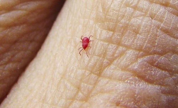 Hình ảnh con mò trên da - Ảnh BVCC sot-mo-1.jpg