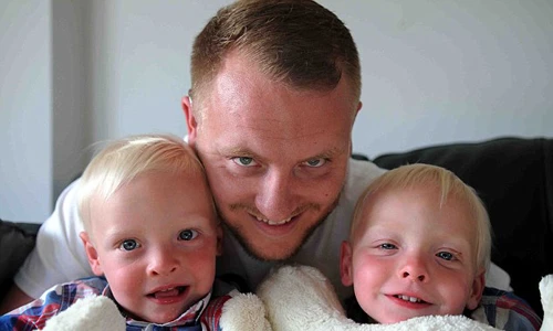 Kỳ lạ cặp sinh đôi có cơ quan nội tạng nằm đối lập nhau