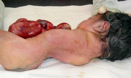 Rùng mình những khiếm khuyết bẩm sinh kinh dị ở trẻ