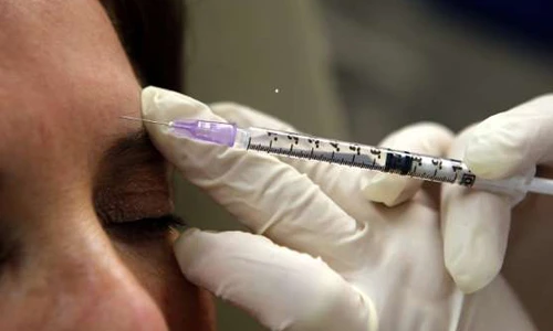7 trường hợp tiêm botox chữa bệnh cực kỳ hiệu quả