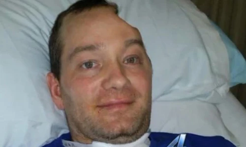 Kinh hãi tù nhân mất nửa đầu vì không được dùng kháng sinh