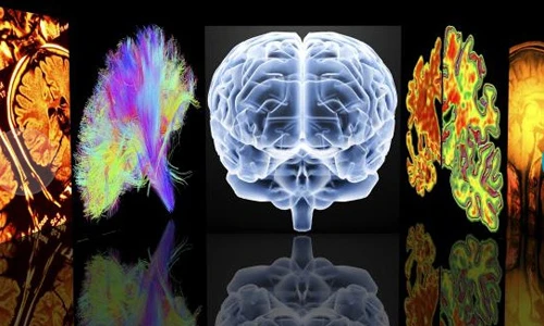 10 loại bệnh sa sút trí tuệ hay gặp nhưng ít người biết