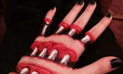 Những hình ảnh ghê rợn về xương khớp người 