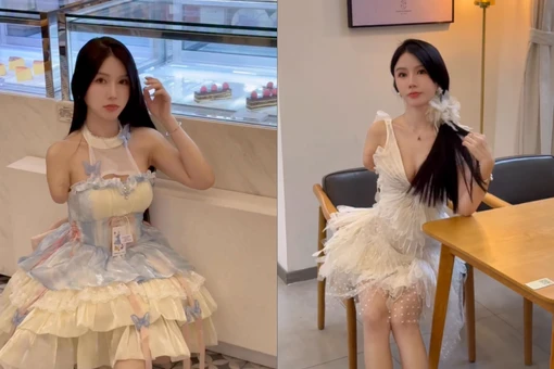 Gặp tai nạn mất một cánh tay, cô gái vẫn nổi tiếng nhờ nhan sắc khó cưỡng