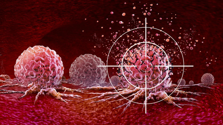 Des protéines conçues par l’IA entraînent les cellules immunitaires à devenir des tueurs de cancer rapidement et en toute sécurité. targeting-cancer-cells-ultrasound.jpg