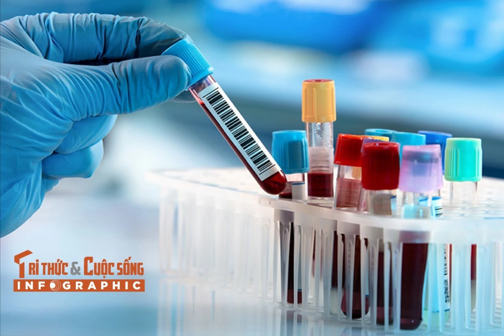 [INFOGRAPHIC] Những xét nghiệm cần thực hiện định kỳ