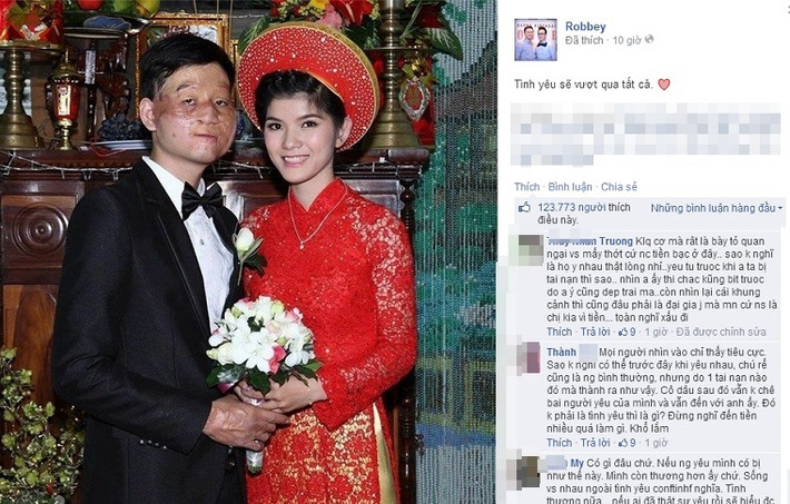 Cư dân trên các trang mạng xã hội đang truyền tay nhau loạt ảnh về một chú rể kém sắc, có khuôn mặt biến dạng hoàn toàn kéo dính lại với nhau, đứng cạnh cô dâu xinh đẹp. Tuy nhiên, cả hai vẫn nở nụ cười rạng ngời và cực kỳ hạnh phúc.