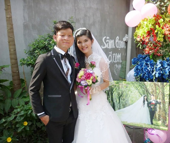 Theo tìm hiểu, cô dâu trong loạt ảnh cưới gây xúc động này tên Thu Hiền, còn chú rể là Trần Lâm. Cả hai đã tổ chức đám cưới vào ngày 20/1/2014, hiện tại đang sinh sống tại TP HCM.