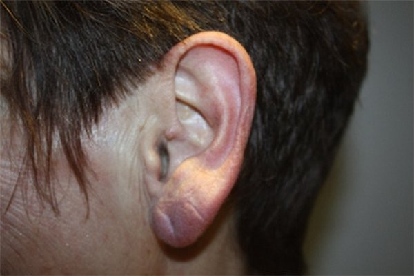 5. Cảm giác đôi tai bị khô héo bất thường: Bạn có nghĩ vành tai khô, khác thường là do cơ thể đã "nghe trước" được một điều chẳng lành nào đó?