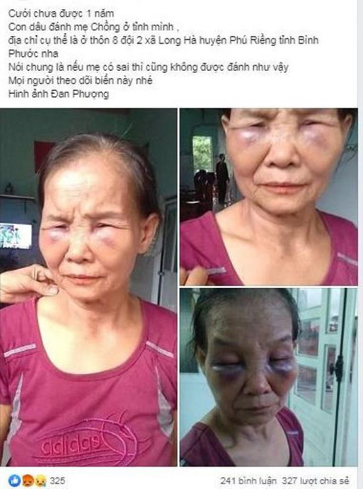 Bà Tạo cho hay: “Nó vào trong thấy rồi quay ra lớn tiếng nói lần sau còn để đây nữa là tôi hất vào phòng của bà. Bực mình quá, tôi với nó lời qua tiếng lại, rồi nó hỗn hào, đánh tôi từ phòng khách vào đến phòng trong. Nó đóng sập cửa lại ghì, kẹp người tôi, túm tóc đánh, đấm, đá tôi liên tục như kẻ thù. Thấy mặt tôi thâm tím, sưng to, nó ngồi xuống khóc xin lỗi bảo tôi đừng nói với ai”.