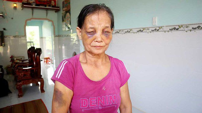 Con dâu túm tóc đánh mẹ chồng sưng mắt, tím mặt chỉ vì… bô nước tiểu: Ngày 1/7/2019, mạng xã hội xôn xao về vụ việc bà Đỗ Thị Tạo (65 tuổi, ngụ tại thôn 8, xã Long Hà, huyện Phú Riềng, Bình Phước) bị con dâu là Nguyễn Thị Thu Tr. (32 tuổi) đánh đập một cách tàn nhẫn, bầm tím hết mặt mày. Sự việc bắt nguồn khi tối 24/6, do thói quen, bà đi tiểu vào bô rồi để cạnh bồn cầu, tính hôm sau đem tưới rau sau vườn.