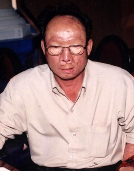 Trong một lần theo Đại Cathay đi đánh nhóm giang hồ khác, Lâm đã liều chết để mở đường cho đại ca thoát chết. Tuy nhiên, Lâm bị đối thủ chém đứt một ngón tay và từ đó gã có cái tên Lâm chín ngón.