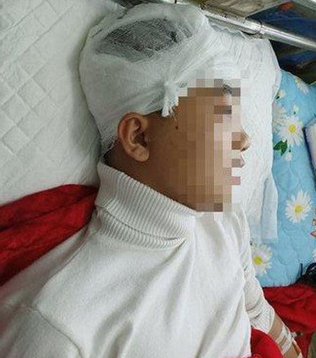Đánh nam sinh lớp 11 chấn thương sọ não: do có mâu thuẫn với nhau nên khi tan trường Nguyễn Bá Thuận (SN 2003, trú tại huyện Lang Chánh, Thanh Hóa) dùng gậy đập vào đầu nam sinh Phan Thanh L. (SN 2004; học sinh lớp 11A6, Trường THPT Lang Chánh) khiến nạn nhân bị chấn thương sọ não. Hôm nay, Công an huyện Lang Chánh đã khởi tố, bắt tạm giam Thuận để điều tra về hành vi "giết người".