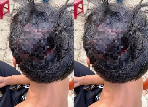 1. Tài xế Vinasun và Mai Linh đánh nhau bể đầu: Ngày 28/9, Công an xã Tam Nghĩa, huyện Núi Thành, tỉnh Quảng Nam cho biết, trên địa bàn xã vừa xảy ra vụ đánh nhau. Do mâu thuẫn tranh giành khách, 3 người đi trên xe taxi Vinasun đã cầm theo vật cứng rượt đánh tài xế taxi Mai Linh. Tài xế taxi Mai Linh đã nhặt được khúc cây và đánh trả. Hậu quả, khiến tài xế taxi Mai Linh bị đánh chảy máu đầu và được đưa đến bệnh viện cấp cứu.