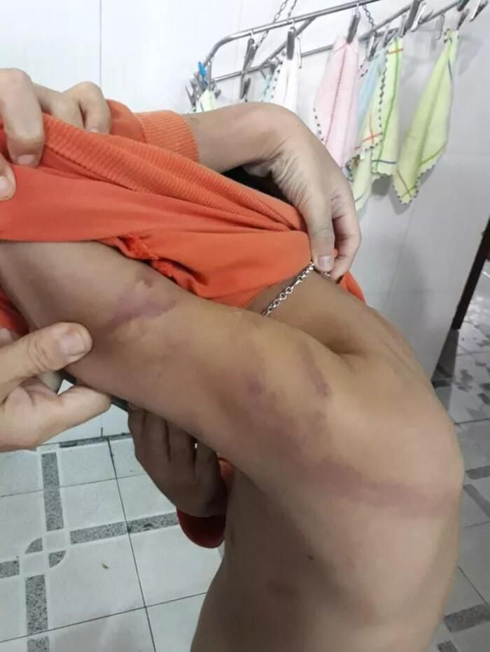 Bé trai 7 tuổi bị cha ruột bạo hành bầm tím cơ thể: Ngày 1/12, Công an phường An Mỹ (TP. Tam Kỳ, Quảng Nam) cho biết, đơn vị vừa đề xuất UBND phường này xử phạt hành chính với ông H.H.T. (33 tuổi; tạm trú trên địa bàn phường) có hành vi bạo hành con ruột của mình là cháu là H.N.N. (7 tuổi). Ông T. nói rằng con trai mình học hành chậm tiến, ở lại lớp, có lần giật tiền của bạn mà không trả khiến ông T. nóng giận và đánh cháu.