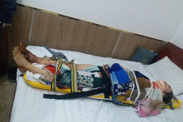 Thang máy khách sạn rơi tự do, cô gái 27 tuổi trọng thương: Sáng 22/1, chị Nguyễn Thị Ngọc H. (27 tuổi, ngụ TP Thủ Đức, TP.HCM) bước vào thang máy ở tầng bốn khách sạn trong hẻm đường Tô Hiệu, quận Tân Phú để đi xuống dưới thì bất ngờ thang máy rơi. Thang máy rơi tự do từ tầng bốn xuống tầng trệt mới dừng lại. Cô gái mắc kẹt bên trong, chấn thương nặng.