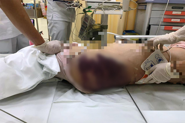 Nghi vấn 'dì ghẻ' bạo hành khiến bé gái 8 tuổi tử vong: Nhiều dấu hiệu cho thấy, nghi can V.N.Q.Tr. (SN 1995, quê Gia Lai, tạm trú quận Bình Thạnh, TP.HCM) đã hành hạ con riêng của người tình, khiến bé N.T.V.A. (SN 2013, trú cùng địa phương) tử vong. Ngày 25/12, Công an quận Bình Thạnh cho biết đã quyết định bắt khẩn cấp Tr. để điều tra.