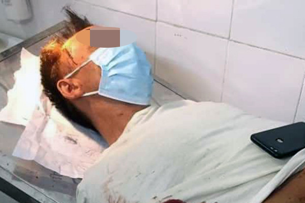 Vợ chém chồng hàng chục nhát dao: Sáng 21/7/2021, người dân khu 10, xã Hướng Đạo (huyện Tam Dương, Vĩnh Phúc) phát hiện một người đàn ông bị chém gục. Theo người dân địa phương, người gây thương tích cho người đàn ông chính là vợ của ông ta. Hai vợ chồng ông H. thường xuyên có mâu thuẫn, cãi vã.