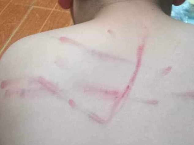 Cô giáo dùng roi tre, đánh bầm tím lưng học sinh vì không làm bài tập: Ngày 2/10/2023, bà Lê Thị Quý, Hiệu trưởng Trường tiểu học Hải Hòa (phường Hải Hòa, thị xã Nghi Sơn, tỉnh Thanh Hóa) xác nhận, có sự việc một học sinh lớp 4 của trường bị cô giáo dùng roi tre đánh vào lưng. Cô H. cho biết nguyên nhân dẫn đến sự việc là do cháu không chịu làm bài tập được giao. Mặc dù đã được nhắc nhở nhiều lần nhưng khi đến lớp, nam sinh này vẫn không chịu tập trung học bài nên cô H. nhất thời tức giận, dùng roi tre đánh vào lưng học sinh. Sau khi sự việc xảy ra, lãnh đạo nhà trường đã cùng cô H. đến nhà học sinh để xin lỗi. Được biết, cô giáo L.H. là giáo viên mới nghỉ hưu. Do thiếu giáo viên nên Trường tiểu học Hải Hòa đã hợp đồng lao động với cô giáo này từ đầu năm học 2023 - 2024.