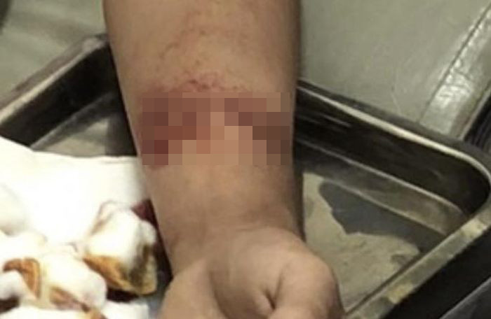 Nam thanh niên tự khứa tay dàn dựng chuyện bị cướp: Ngày 25/4, Công an huyện Hàm Tân, tỉnh Bình Thuận cho biết đang lập hồ sơ xử lý Trần Hữu Sang (20 tuổi, trú huyện Xuân Lộc, Đồng Nai) về hành vi báo thông tin giả về việc bị cướp tài sản xảy ra tại địa bàn Hàm Tân. Sang khai nhận, chiều 24/4, Sang đem 1 lắc tay vàng và 1 nhẫn vàng đến cầm tại một tiệm vàng thuộc huyện Xuân Lộc được 13,5 triệu đồng. Sau đó, Sang dùng số tiền trên để nạp vào một phần mềm dạng chứng khoản ảo và bị lừa hết. Sợ người nhà biết, Sang dùng dao lam khứa nhiều vết vào tay trái và chạy về nhà thông báo bị cướp. Hiện cơ quan chức năng đang củng cố hồ sơ để xử lý theo quy định.