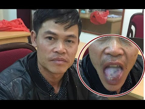 Ngày 12/5, Cơ quan CSĐT Công an huyện Cầu Kè (Trà Vinh) cho biết đang tạm giữ hình sự Sơn Sa Rót (23 tuổi, ngụ xã Phong Thạnh) điều tra về hành vi trộm cắp tài sản và hiếp dâm.