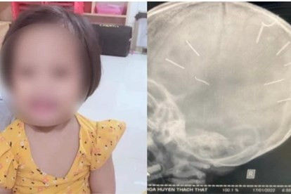 Khoảng 8h ngày 17/1/2022, khi chị L. đi làm, Huyên hỏi nhưng thấy cháu A. không trả lời nên đã tát cháu A. nhiều lần rồi lấy đinh ghim vào đầu cháu A. Sau đó, Huyên đưa cháu đến nhà người trông trẻ gửi rồi về phòng trọ ngủ.