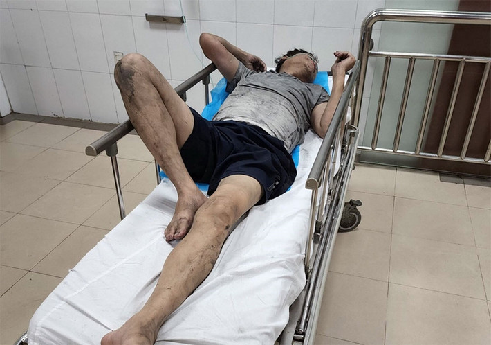 Đến thời điểm này, 3 nạn nhân sức khỏe bình thường, 1 nạn nhân bị bỏng đang điều trị tại Bệnh viện 103.