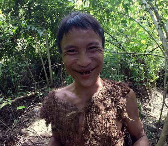 Hình ảnh người rừng Hồ Văn Lang thời điểm mới được gia đình tìm thấy trong rừng năm 2013 và đưa về nhà.